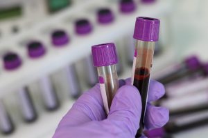 diagnostic blood work for senior dogs and cats